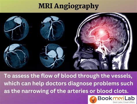 Angiogram For Blood Vessels: Price of the Procedure.